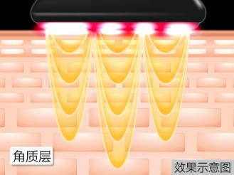 4種功能