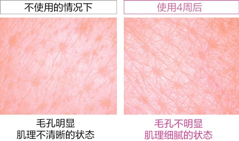 NEW 使用4周，即可實現紋理細膩的肌膚