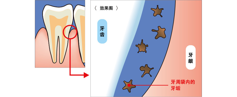 口腔沖洗器 - 送禮佳選
