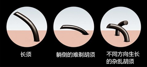 Check！剃須殘留的主要原因