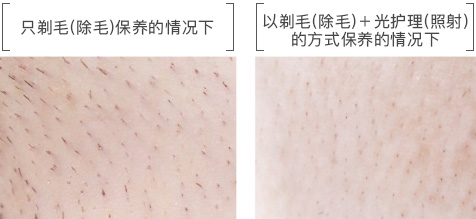 高能量雙燈照射